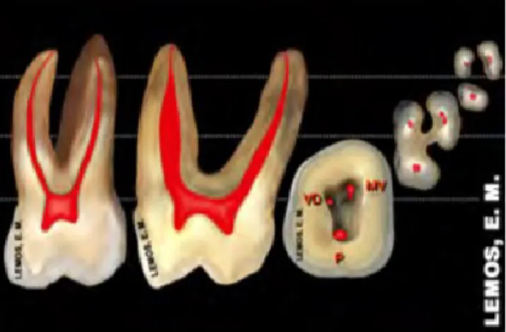 Figura nº3. - Anatomia interna do primeiro molar superior permanente (Endo ‐ e, 2013)  (6).