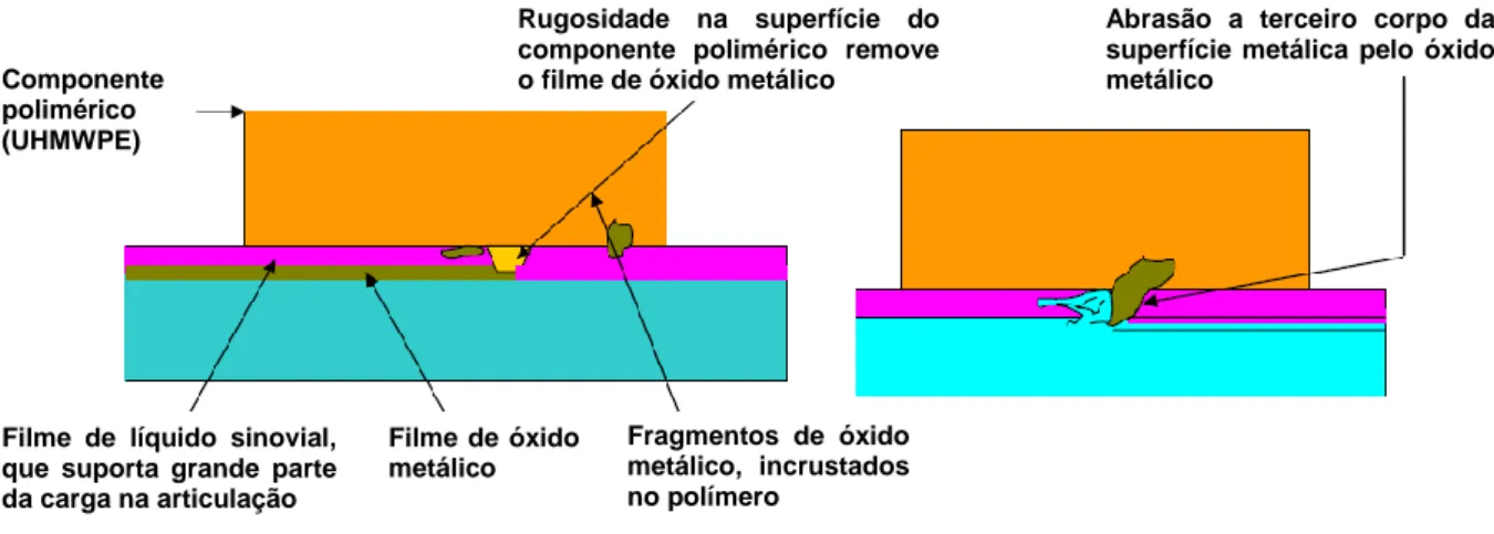 Figura 30 – Mecanismo de corrosão nas próteses ortopédicas do tipo Metal / UHMWPE (adaptado de  Batchelor e Chandrasekaran, 2004) 