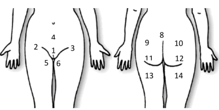 Figura 1: Áreas anatómicas frequentemente atingidas por DAI. 