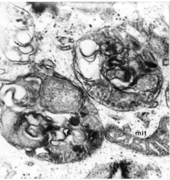 Figura 4 (X 40.000) - Micrografias eletrônicas de transmissão de hemócitos 