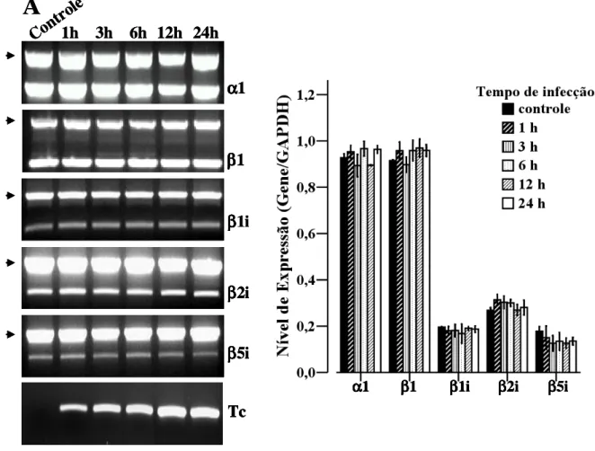 Figura 6. Análise comparativa da expressão dos genes  α α1, β α α β β β1,  β β β β1i, β β β β2i e  β β β β5i, de células  HeLa controle e infectadas por diferentes tempos com T