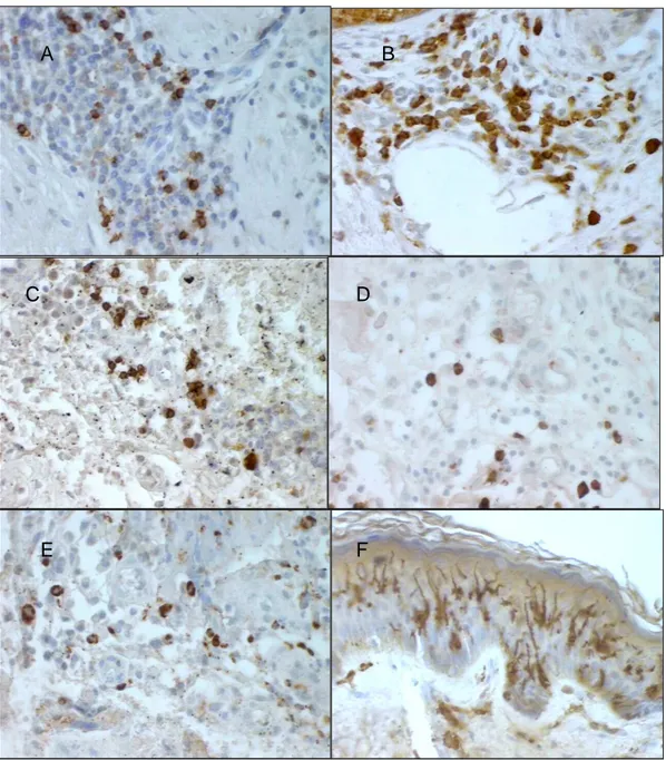 Figura 11 - Cortes histológicos corados por imuno-histoquímica no controle. Células positivas estão coradas em  marrom