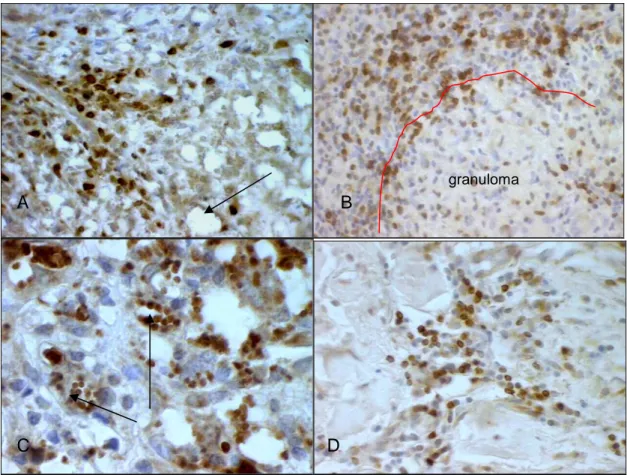 Figura 17 - Cortes histológicos corados por imuno-histoquímica. Células positivas coradas em marrom