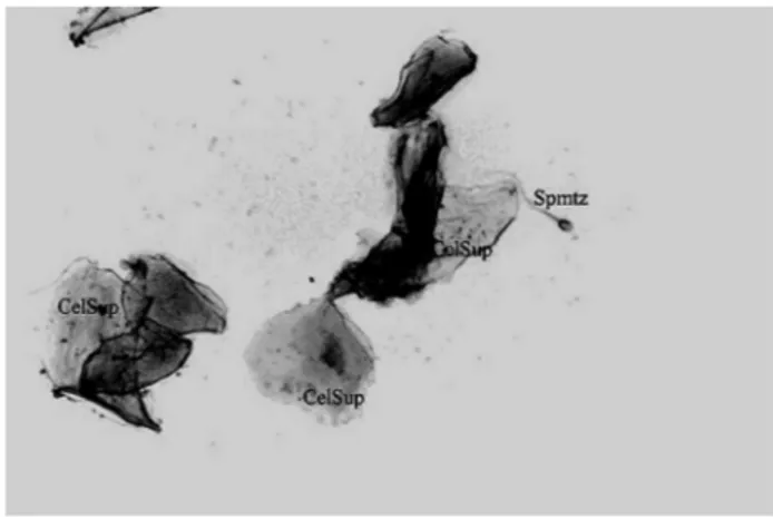 Figura 4 - Citologia esfoliativa característica da fase de estro.CelSup: Célula 