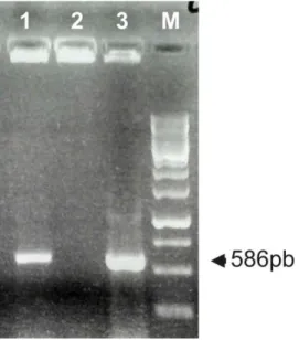 Figura 3: Gel de agarose 0,7% apresentando a amplificação de bandas de aproximadamente 586 pb  correspondentes  ao  gene  RcDREB1  em  três  colônias  de  A