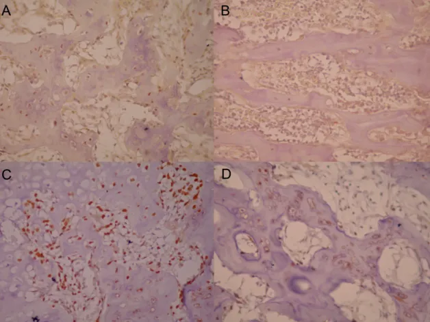 Figure 1 Representative immunohistochemical reactivity for RANKL (A, B) and OPG  (C, D) at sites of tibia fracture of control (A, C) and alloxan-induced diabetic rats (B, D)  at  14  days