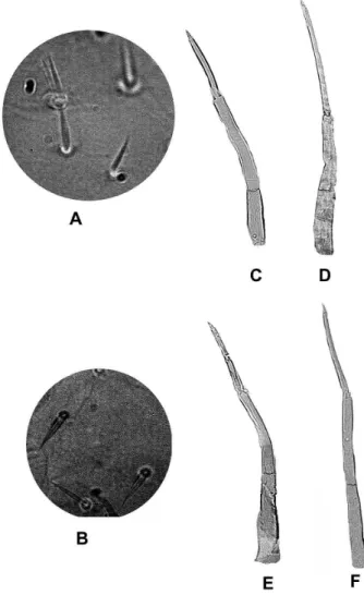 Figura 4 - a-b- setas do apódema cefálico larval; a- Shelleyellum lourencoi; b- Shelleyellum siolii; f- antenas de larvas;  c-Shelleyellum damascenoi; d- c-Shelleyellum guaporense;  e-Shelleyellum lourencoi; f- e-Shelleyellum siolii.