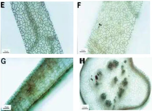 Figura 3 -  Lâmina foliar : E - Vista frontal da epiderme adaxial; F - Vista frontal da epiderme abaxial com estômatos anomocíticos (ea); G - Mesofilo dorsiventral com uma camada de tecido paliçádico e um parênquima  lacunoso desenvolvido; H - Nervura medi