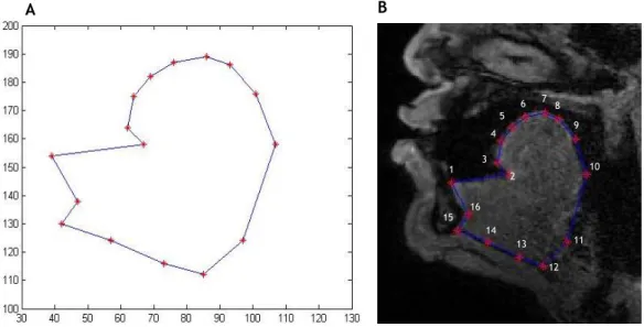 Figure 16 - Initial landmark map defined by hand representing the landmark connectivity (A),  and in the image referential (B)