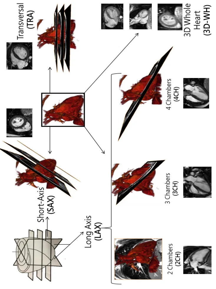Figure 5.1.1 –Examples of images from the CMR sequences used for the reconstruction of the inner LV