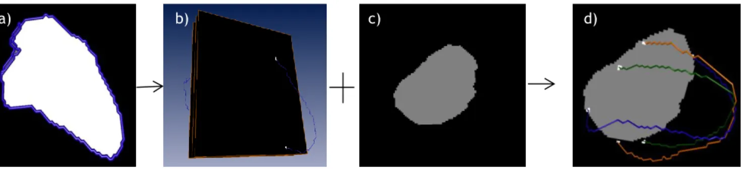 Figure 5.6 –  Process to obtain a stack of labeled SAX (or  TRA) images and the correspondent intersections with the LAX  contours