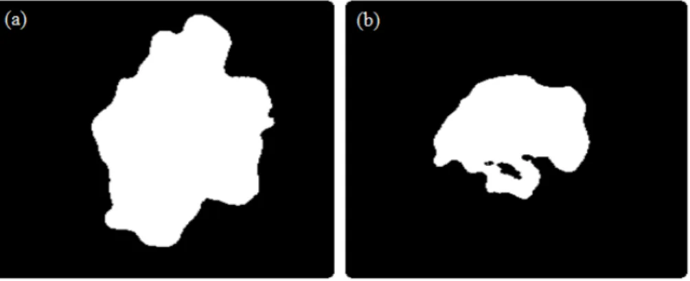 Figure 5 - Segmentation results after applying Otsu’s method (a) to the dermoscopy image shown in  Figure 4a, and (b) to the macroscopic image shown in Figure 4b