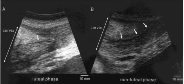 Figure  6:  Ultrasound  images  of  the  cervix  in  an  African  elephant  (in  longitudinal  view)  (Source: 