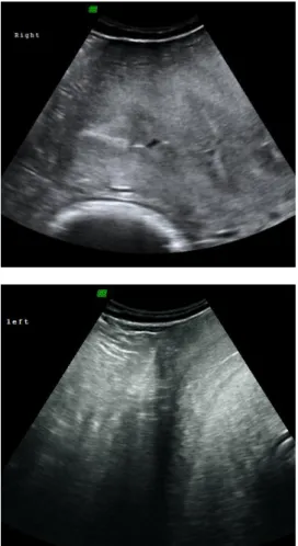 Figure  9:  Ultrasound  image  of  the  uterus  horn,  presenting  thickened  endometrium  and  mucous  content  in  the  lumen  near  ovulation  (Courtesy  of  Dr  Thomas  Hildebrandt,  Department  of  Reproduction  Management  –  IZW,  Germany).