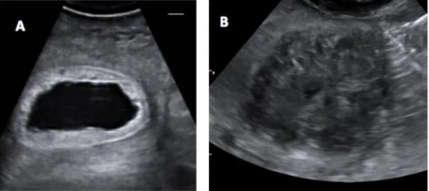 Figure  16:  Examples  of  pathological  uterine  findings  during  ultrasound  in  female  Asian  elephant