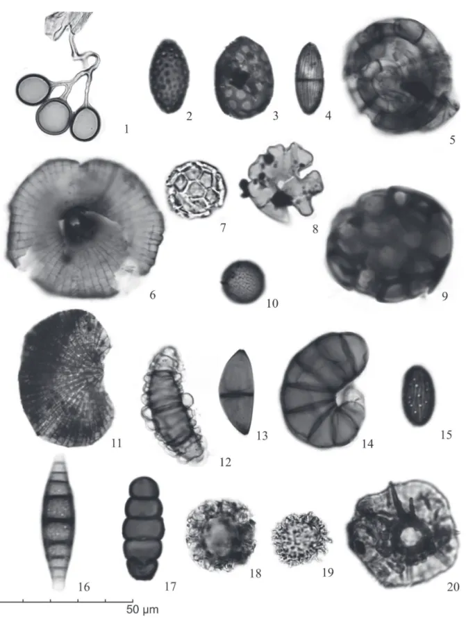 Figura 2.  Fotomicrografi as de palinomorfos selecionados. Esporos: 1. Glomus; 2. Gelanispora calospora; 3