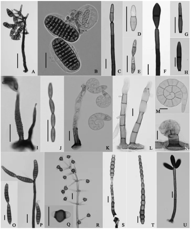 Figura 1. Conidióforos, células conidiogênicas e conídios de fungos conidiais. A. Acarocybellina arengae - aspecto geral do conidióforo com células conidiogênicas 