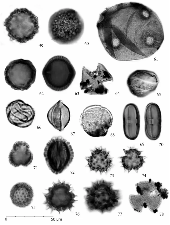 Figura 5. Fotomicrografias grão de pólen de angiospermas: 59-60. Tipo Tournefortia c.f.; 61