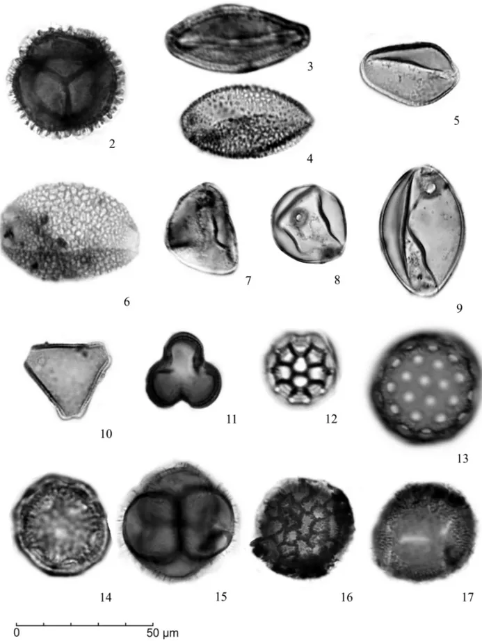 Figura 2. Fotomicrografias grão de pólen de angiospermas: 2. Drimys brasiliensis; 3. Tipo Iridaceae; 4