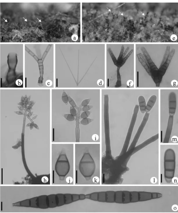 Figura 1.  a-d. Actinocladium longiramosum (R.F. Castañeda) R.F. Castañeda – a. conídios sobre substrato natural (setas); b