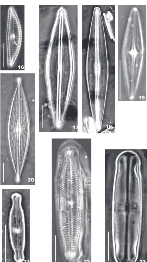Figura 16.  Encyonema hebridicum; 17. F. crassinervia; 18. F. saxonica; 19. Brachysira brebissoni; 20