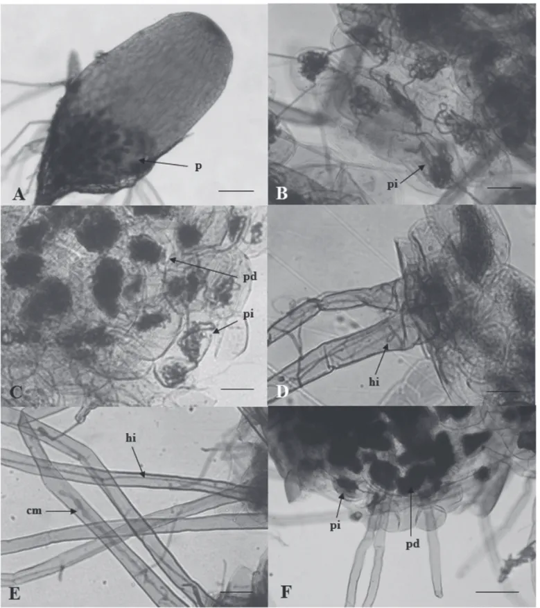 Figura 4.  Colonização das células dos protocormos de Epidendrum secundum por fungos Epulorhiza spp