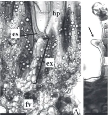 Figura 6. Emergências em Macairea radula (Bonpl.) DC. A. Detalhe mostrando  a base da esclereíde (es) em contato com a extensão da endoderme (ex)