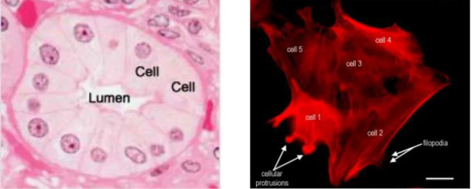 Figure 7. Histology picture of a set of cells lining a duct stained with H &amp; E (on  the left), and a histology image stained with immunohistochemical techniques  to enhance, in red, the presence of the protein actin in the cells (on the right)