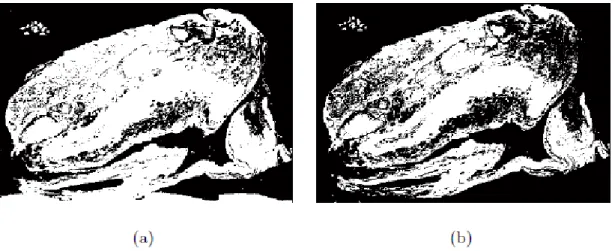 Figure 11: Relevant tissue structure segmented using (a) the global thresholding approach and (b)  k-means algorithm