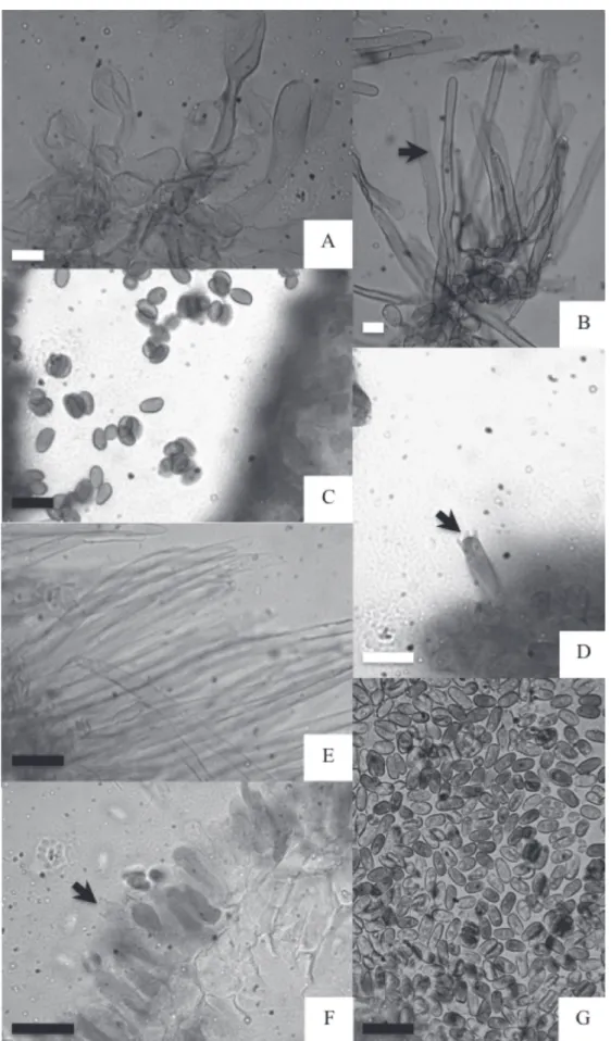 Figura 5. A-D Lepiota echinella var rhodorhiza (Romagn. &amp; Locq. ex P.D.Orton) Hardtke &amp; Rödel