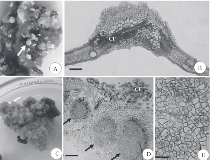 Figura 1. Aspectos morfológicos e histológicos dos calos de C. echinata cultivados in vitro