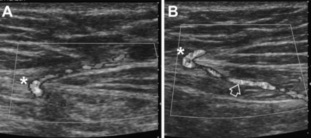 Figure 2.9 shows an example of an image acquired through this technique.