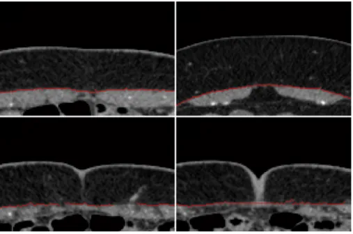 Figure 5.10: Raw fascia segmentation of the example images of Figure 5.3.