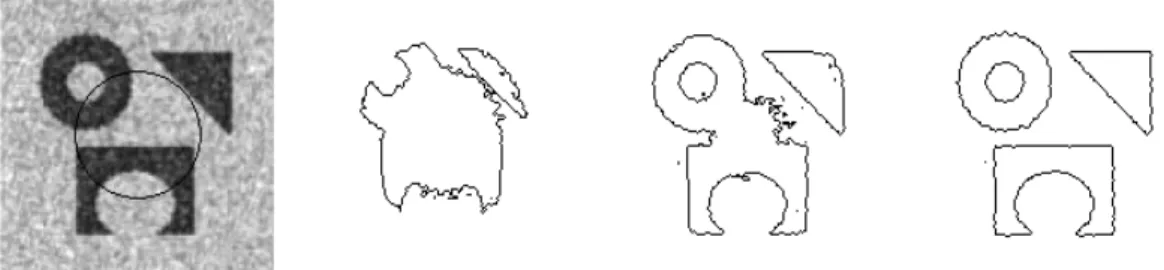 Figure 12.  Segmentation example using Chan-Vese’s model: initial contour (left), intermediate contours (centre),  final contours (right)