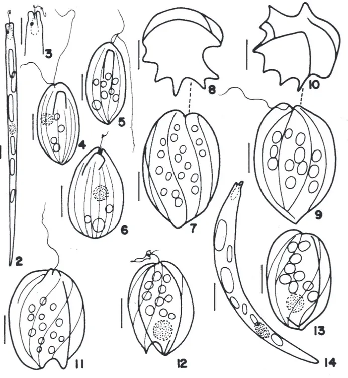 Figura 2-14. 2-3. Cyclidiopsis acus Korschikow, 3- detalhe do pólo anterior. 4-6. Entosiphon polyaulax Skuja
