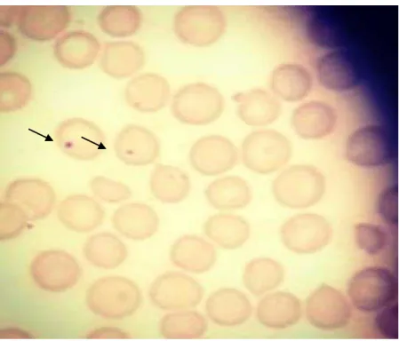 Figura  2  -  Eritrócitos  de  camundongos  tratados  com  ciclosfofamida (50mg/kg) - controle positivo