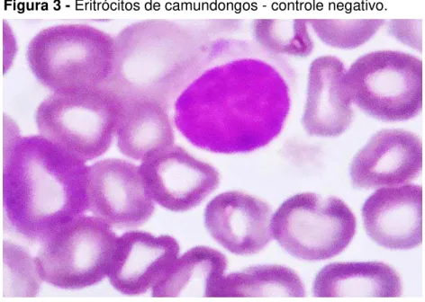Figura 3 - Eritrócitos de camundongos - controle negativo. 