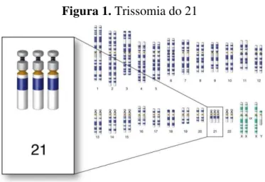 Figura 1. Trissomia do 21 
