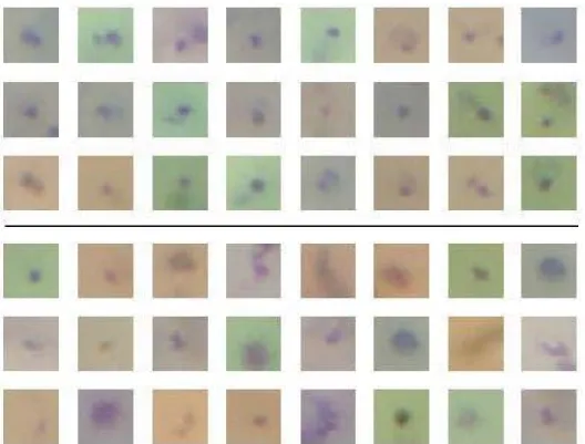 Figure 2.5: Illustrative examples of thin smear cropped sub-images acquired with mobile devices, with positive cases at the top and negative cases at the bottom (from [47]).