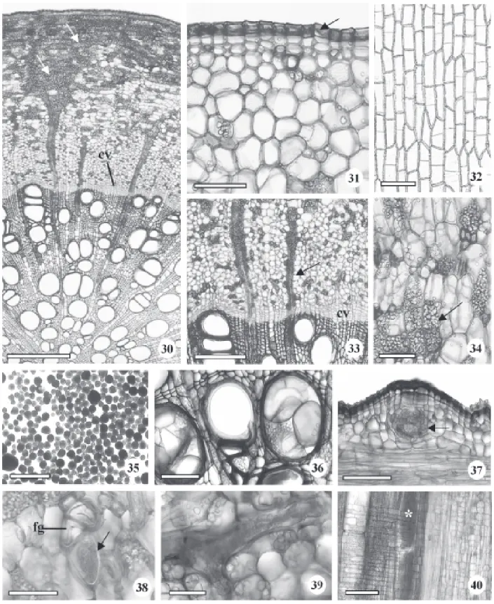 Figura 30-40. Secções transversais (30, 31, 33, 34, 36 e 38), paradérmica (32) e longitudinais (37, 39 e 40) da raiz gemífera da planta adulta de Brosimum gaudichaudii Trécul