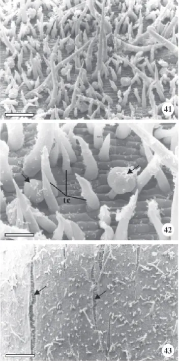 Figura 41-43. Vista frontal do caule jovem (41 e 42) e adulto (43) de Brosimum gaudichaudii Trécul em microscopia eletrônica de varredura