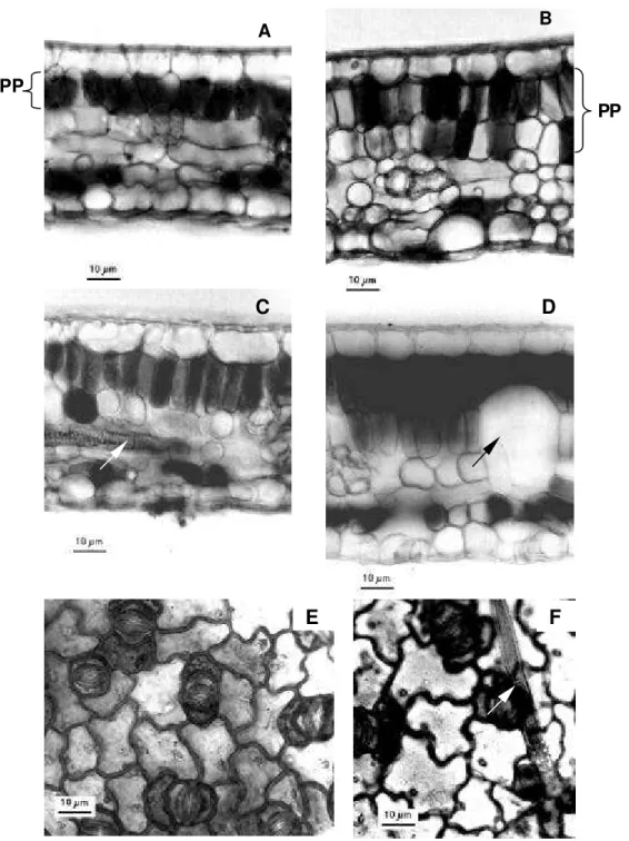 Figura 1. Fotomicrografias de seções transversais (A-D) e paradérmicas (E e F) do limbo foliar de Xylopia brasiliensis Sprengel