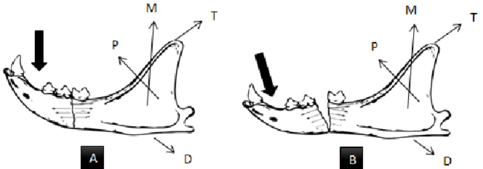 Figura 3. A – Fratura mandibular favorável. B – Fratura mandibular desfavorável. Original