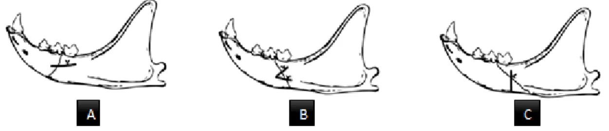 Figura 4. Exemplos de aplicação de arames interfragmentários. Notar diferenças de aplicação em  fraturas favorável (A) e desfavoráveis (B e C)
