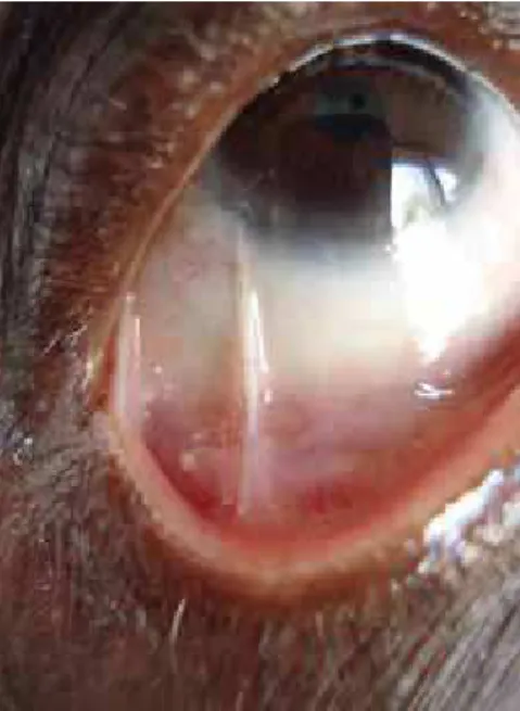 Figura 1: Erosões na mucosa labial e língua F IGURA 2: Simbléfaro  temporal inferiorno olho direito