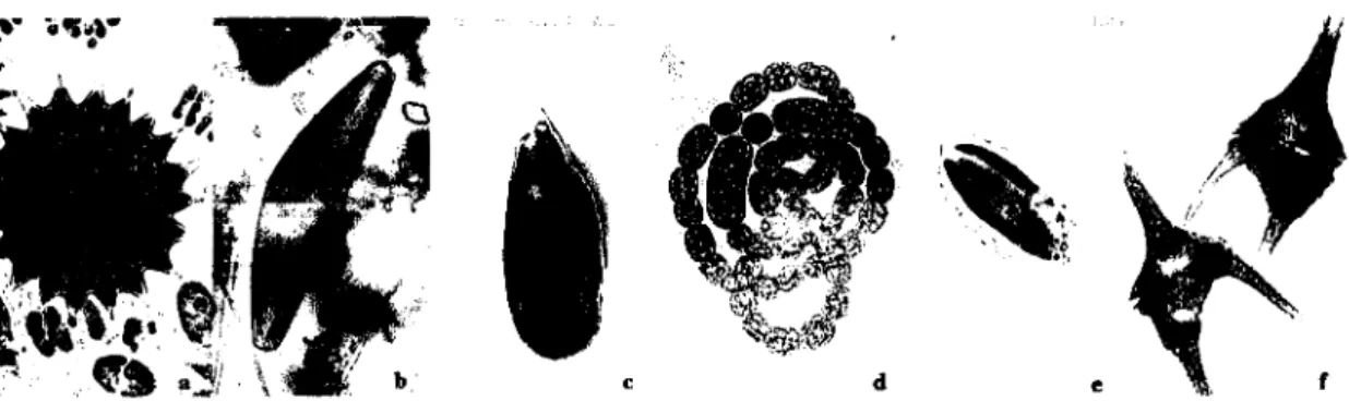 Figura 1 - Exemplares dos principais grupos fitoplanctónicos dulciaquícolas: a) clorófita; b)  diatomácea; c) criptófita; d) cianobactéria; e) crisófita; f) dinoflagelado (adaptado  de Lund &amp; Canter-Lund, 1995) 