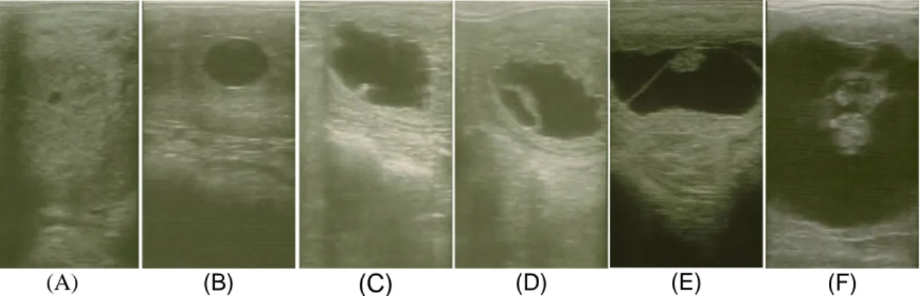 Figura 2 – Imagens ecográficas de diagnósticos de gestação precoce de  éguas com 11 dias  (A), 16 dias (B), 21 dias (C), 23 dias (D), 36 dias (E) e 45 dias (F) de gestação