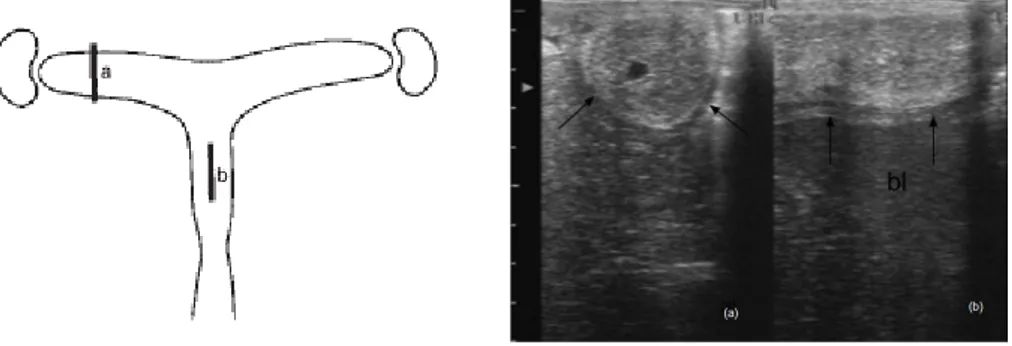 Figura 7  – Representação esquemática do útero de uma égua em diestro, demonstrando a  posição  da  sonda  ecográfica  em  relação  ao  corno  (a)  e  o  corpo  uterino  (b)  e  a  respectiva  imagem ecográfica
