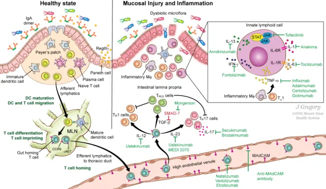 Figure 3 - Overview of the intestinal immune system in health and IBD. During the healthy state  (left side of the figure), the intestinal epithelium and IgA dimers work in concert to regulate and  separate the luminal microflora from the mucosal immune sy