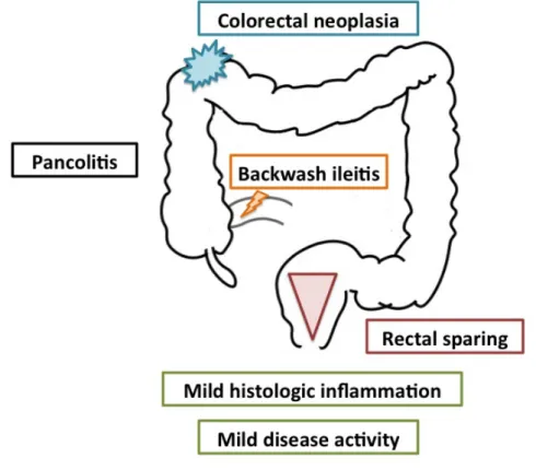 Figure 6 - The special phenotype of PSC-IBD. Patients with PSC-IBD present more often extensive  but mild colitis, backwash ileitis, rectal sparing, and right-sided colorectal neoplasia